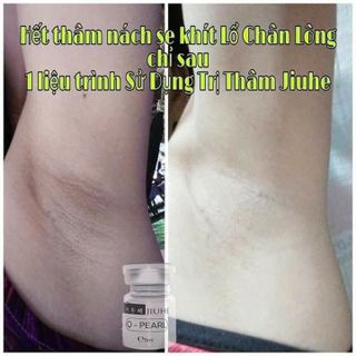 Serum trị thâm jiuhe