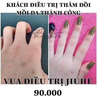 Serum trị thâm jiuhe