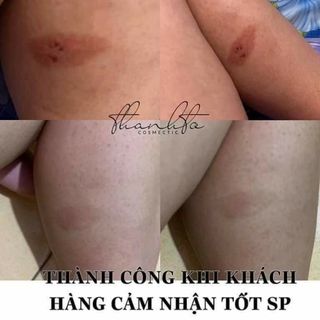 Serum trị thâm jiuhe