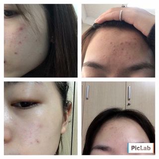 SỮA RỬA MẶT ‘’ĐẶC TRỊ DÀNH RIÊNG CHO DA_DẦU_MỤN - Laroche Posay