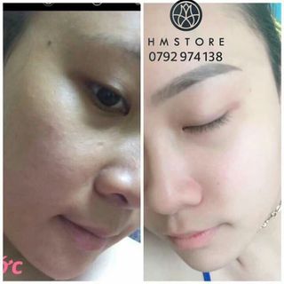 Kem Trắng Hồng Căng Bóng