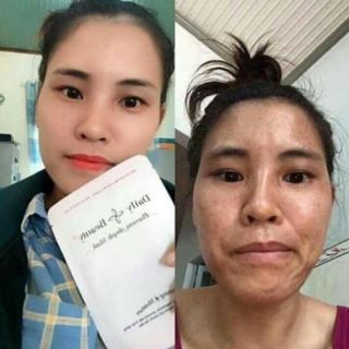 MẶT NẠ TẾ BÀO GỐC NHAU THAI CỪU HÀN QUỐC