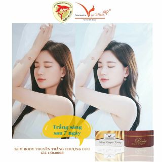 Body thượng lưu