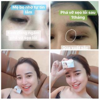 Trị sẹo Collagen DrEvaMoon