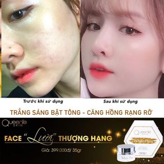 Kem dưỡng da Lười Thượng Hạng Queenie skin