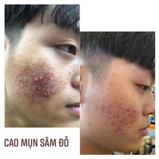 Cao sâm đỏ hộp lớn