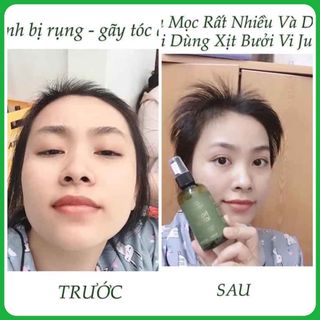 [100 mọc tóc] tinh dầu bưởi KÍCH MỌC TÓC vijully Cao Cấp Trị Rụng Tóc - Phục Hồi Tóc