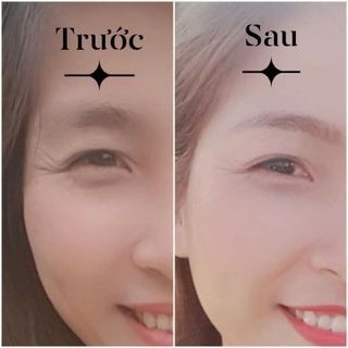 Giá sỉ Kem mắt Hanco ( hàng cty)