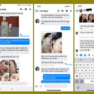 Kem Trị Nám Indimeric 7 Ngày