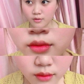 Sáp Trị Thâm Beelip - Concentrated Cream