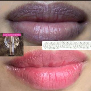 Kem trị thâm môi XLip - XXvirgin L - 5ml Gcell Hàn Quốc