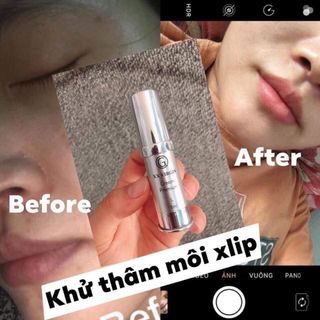 Kem trị thâm môi XLip - XXvirgin L - 5ml Gcell Hàn Quốc