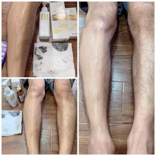 Kem Tẩy Lông Mamen - triệt lông vĩnh viễn