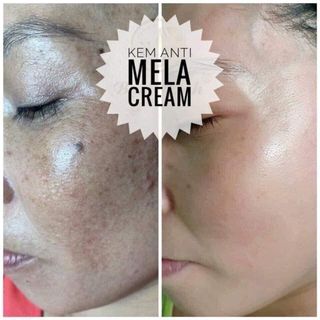 Kem huyết tơ tằm