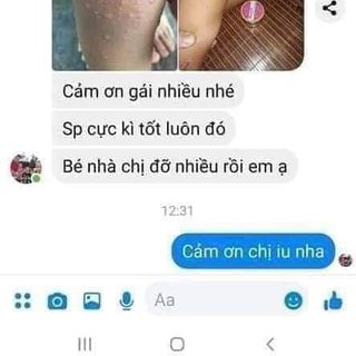 Kem đa năng Mul Rose trị mụn, viêm da cơ địa, mẫn ngứa, hăm sảy, rạn nứt da