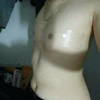 Keo Dán Ngực Trong Suốt Chống Nước 15cm Tomboy Sb Trans