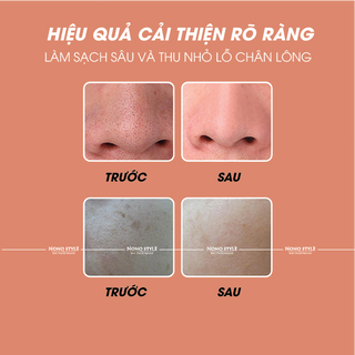 MÁY HÚT MỤN ĐẦU ĐEN CẦM TAY MINI LÀM SẠCH TRẺ HÓA DA CAO CẤP