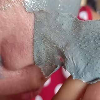 gel lột mụn từ tro núi lửa DR. Ance