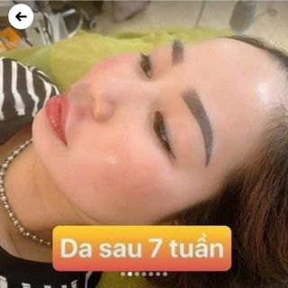 Tái tạo nhân sâm MQ Skin có sẵn