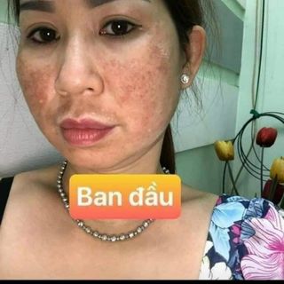 Tái tạo nhân sâm MQ Skin có sẵn
