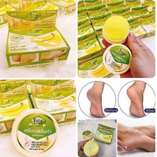 Kem trị nứt gót chân