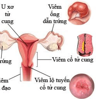 PHỤ KHOA DIỆP TỐ NHƯ