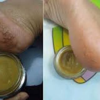 Cao lá Thanh Mộc Hương Ngừa Trĩ Rạn Da..