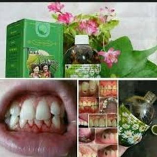 SÂU RĂNG THANH MỘC HƯƠNG
