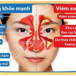 XOANG THANH MỘC HƯƠNG