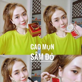 Cao mụn sâm đỏ đánh bay các loại mụn