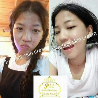 Kem ốc sên White Snail Goldd