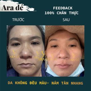 ARA DÉ CHAI NHỎ 50ml - Sỉ Chiết Khấu 40%
