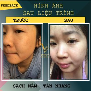 ARA DÉ CHAI LỚN 100ml - Sỉ Chiết Khấu 40%