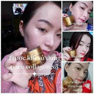 Kem face collagen giá sỉ