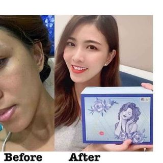 Viên uống trắng da hộp xanh