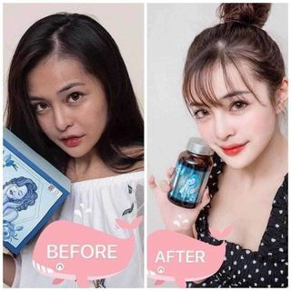Viên uống trắng da hộp xanh