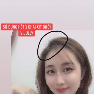 TINH DẦU BƯỞI VIJULLY - GIẢM RỤNG MỌC NHANH