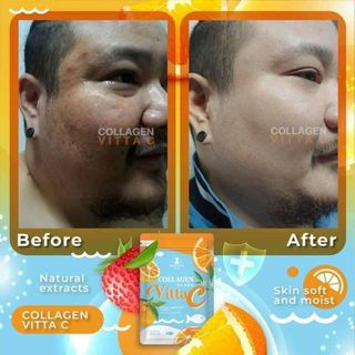 Viên uống Collagen Vitta C Precious Skin Thailand 60 viên