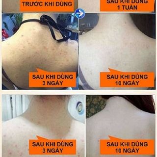 Xà phòng đa năng nội địa (tặng lưới tạo bọt)*