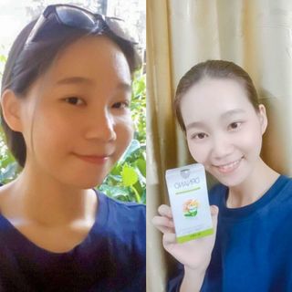 Viên uống trắng da mờ nám DR NANO ROYAL - Minhlady Beauty