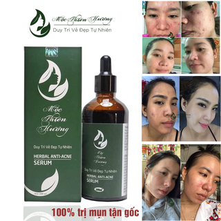 Serum Đánh Bay Mụn Thâm Mộc Thiên Hương 100ml