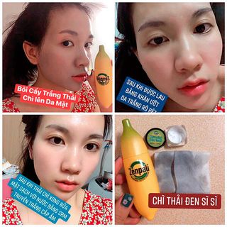 Detox Cấy Trắng Thải Chì Zenpali