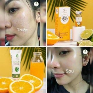 SERUM 7 DAY OLIC DƯỠNG DA TRẮNG MỀM MỊN##GM