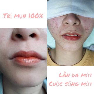 Mỹ phẩm thanh dược