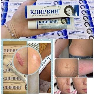 Kem sẹo Nga,làm mờ sẹo lồi, sẹo lõm và sẹo rỗ và vết thâm