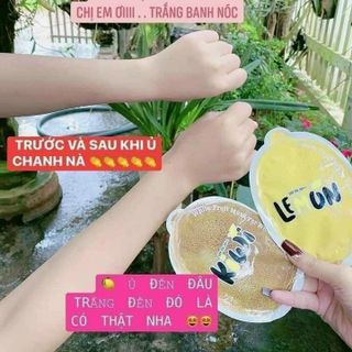 Ủ trắng chanh lemon giá sỉ