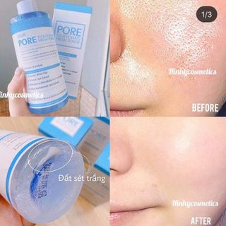 Toner Pore Tightening Fresh Cấp Ẩm Da