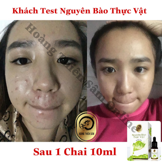 Nguyên Bào Thực Vật ( Tặng Thẻ cào 50k)