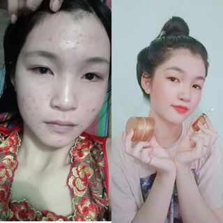 Combo face serum collagen x3