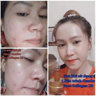 Combo face serum collagen x3